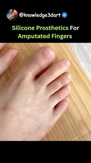 Silicone Prosthetics For Amputated Fingers 😍