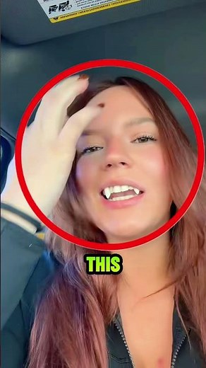 Halloween Gone Wrong: Stuck Vampire Teeth 🧛‍♀️
