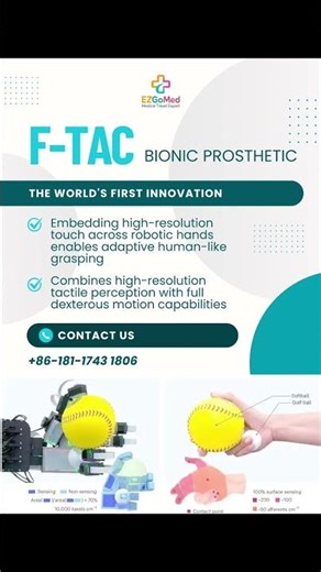 🇨🇳 China's Bionic Revolution: Feel, Move, Thrive