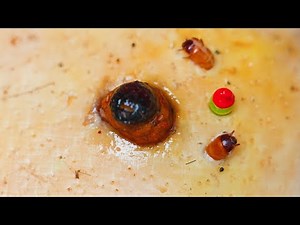 Dr. Lee Geoff Butler Enilsa MrPopZit 🌝 Professional pedicure process 【Xue Yidao】🌝 #180459