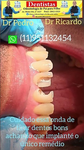 Tooth reconstruction