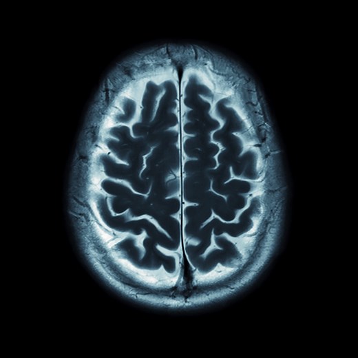 Technology - iAwake Technologies