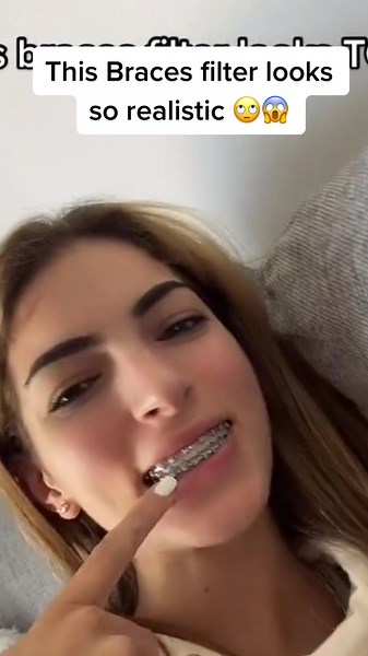 Realistic Braces Filter on TikTok