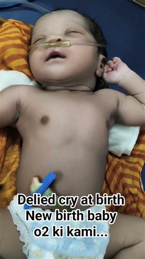 delied cry at birth New born baby me O2 ki kami...#nursing #hospital #nicu #youtubeshorts #nurselife