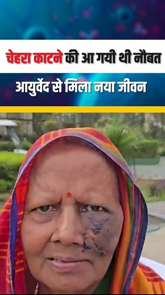 Ayurvedic Treatment of Cancer I Angiosarcoma Treatment I Rare Cancer Success Stories I Hiims