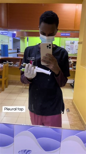 Understanding Pleural Tap Procedures for Medical Interns