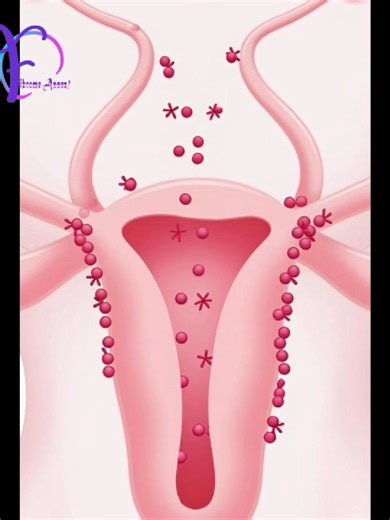 Vidéo éducative médicale animée, style animation 3D réaliste et pédagogique. Représentation non graphique, respectueuse et claire de l’utérus féminin. Montrer progressivement le processus de formation du fibrome : – cellules musculaires de l’utérus normales, – dérèglement hormonal, – multiplication cellulaire lente, – apparition d’une masse bénigne (fibrome) #sensibilisation #santé #fibrome #femme