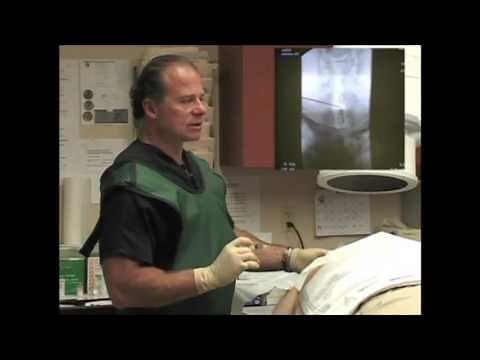 Interlaminar Cervical Epidural