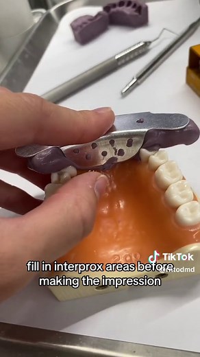 TW: epilepsy (the dental light will flash!) (This is #21 in the international IDF nomenclature, and #9 in the universal nomenclature.) It’s only my 2nd crown prep be kind 😎🫶 p.s.: in my school we use a nomenclature from the IDF where the 1st number is the quadrant and the second one is the tooth within that quadrant. Therefore, the central upper left incisor is n°21. The lateral incisor next to it is 22, the upper left canine is 23, and so on, as we are in the 2nd quadrant. I love our labs thi