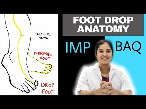 Foot Drop and Peroneal Nerve injury | Case presentation and management | Medseed MBBS
