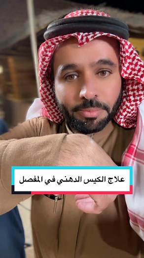 علاج الكيس الدهني بطريقة سهلة وسريعة
