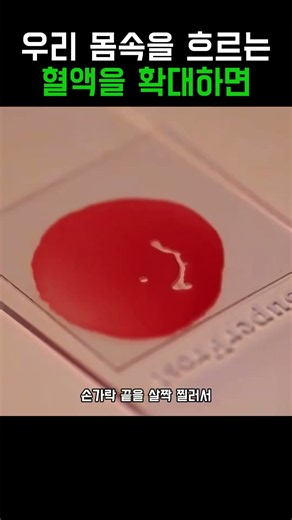우리 몸속을 흐르는 생명의 강 혈액 현미경 관찰