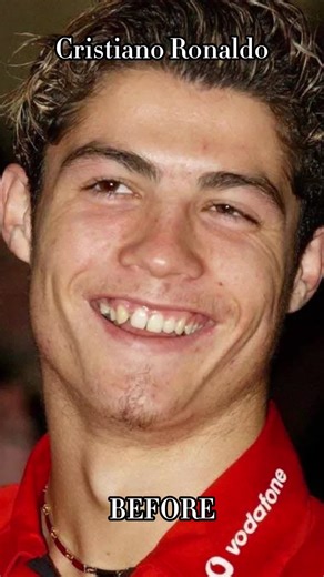 Celebrities' Amazing Smile Transformations with Dental Implants!