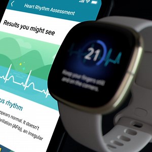 Fitbit Sense now has a compatible ECG app that lets you assess your heart for signs of AFib right on your wrist. | Fitbit