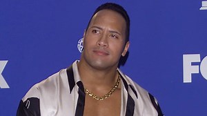 How plastic surgery changed these icons