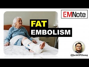 Fat Embolism Syndrome: The Hidden Danger After a Fracture