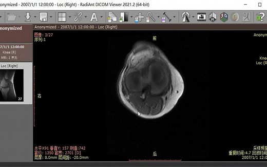 RadiAnt DICOM Viewer 医学影像浏览看图软件 安装视频攻略 3分钟教你
