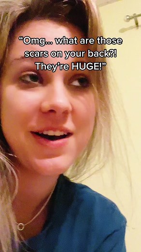 She shouted this, at a pool, in front of 20 people, I was mortified. I didn’t know that wasn’t a normal thing.