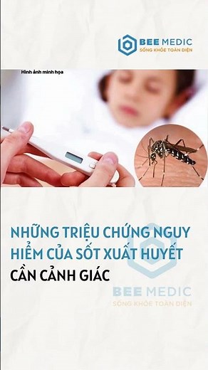 Những triệu chứng nguy hiểm của sốt xuất huyết | BEE MEDIC