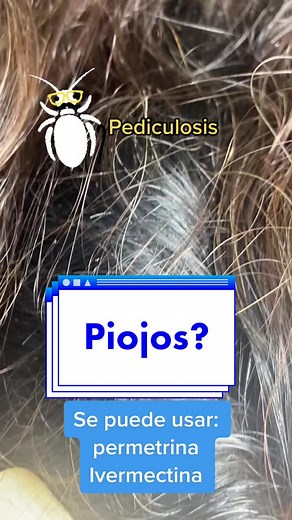 Tratamiento para Piojos y Pediculosis: Permetrina e Ivermectina