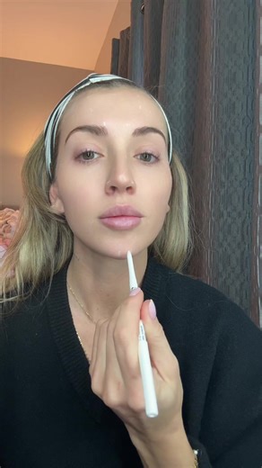 Prefer my face frozen, like my soul 🖤 Frontals: 10 units Crows feet/brow lift: 20 units Lip flip: 8 units Chin: 6 units Nasal slimming/bunny lines: 12 💉54 units Using Xeo! #nursesoftiktok #crna #nurseinjector #nurselife #fyp