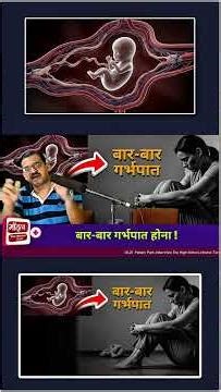 Recurrent Pregnancy Loss क्या हैं ?