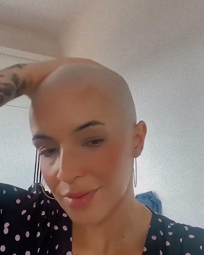 Beautiful Lady Shows Her Bald Head