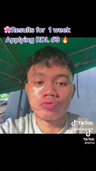 RDL 3 Result #rdl #rdl3 #budolfinds #skinozaph #affodable #budolskinozaph #fyp #fypシ #tiktokfinds