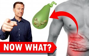 胆囊手术（切除）？看这个！ 2021年12月5日 Gallbladder Surgery (Removal) WATCH THIS!