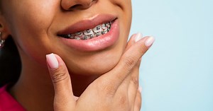 How Much Do Braces Actually Cost These Days?