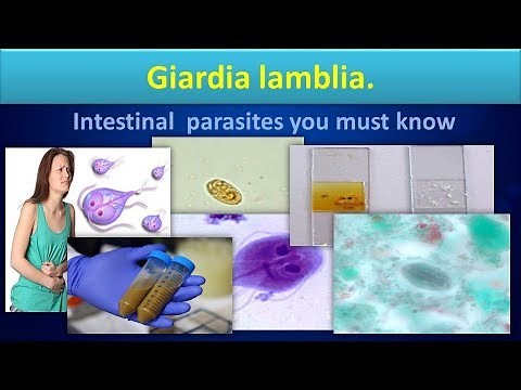 Giardia lamblia(Life cycle,Structure,Labdiagnosis,Giardiasis,Clear overview).