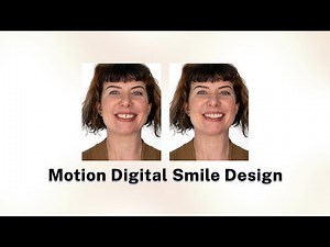Motion Digital Smile Design
