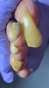This nail cleaning took a shocking twist 9Q8L Beautiful moments of care and relaxation through a gentle pedicure experience. Simple, clean, and satisfying. 🌿✨ Disclaimer: This video is for educational and relaxation purposes only. All content belongs to the respective owners, no copyright infringement is intended. | Marcia Villa