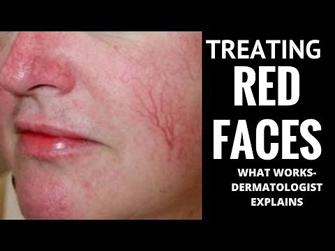 How to treat red faces