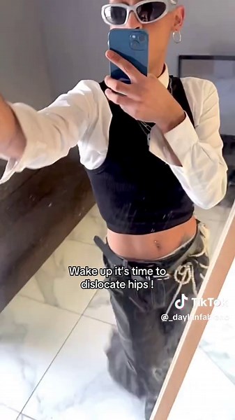 Understanding Hip Dislocations and Their Implications