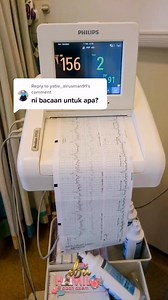 CTG dan Proses Bersalin: Panduan untuk Ibu Hamil