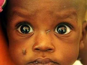 The Starving Chlidren of Africa