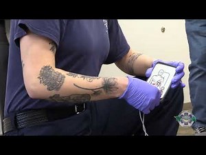 Anterior Posterior: Early Placement of the Lucas Device