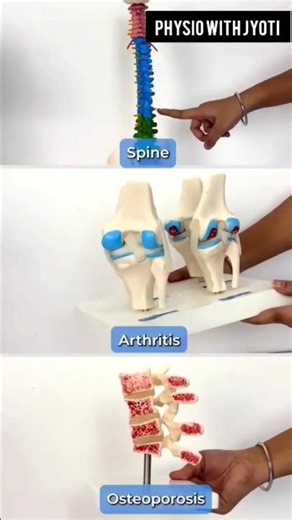 Body Parts Model Explanation for Students | Human Anatomy | ♥️Physio With Jyoti