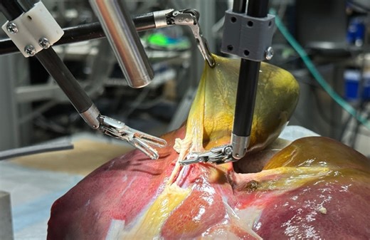 Johns Hopkins teaches robot to perform a gallbladder removal on a realistic patient - The Robot Report