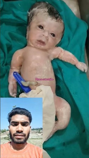 Abnormal Baby Birth defects