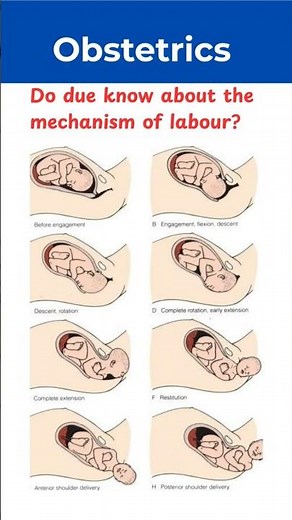 mechanism of labour