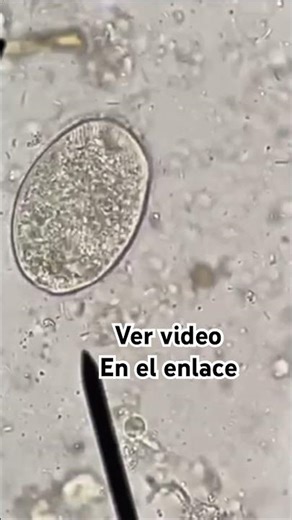 Protozoa in motion 🔬