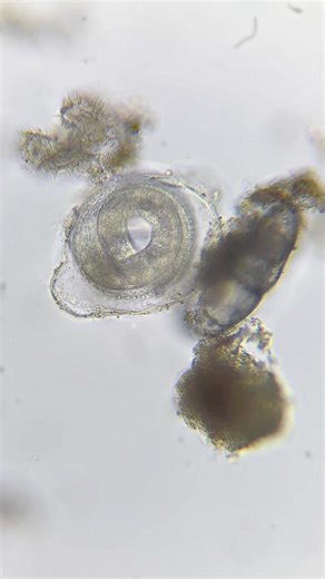 Wormy timelapse! Egg capsule with baby worm (I assume). #marinebiology #zooplankton #microscopy #plankton #worms