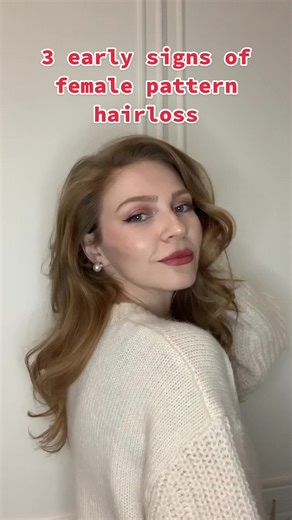 Understanding Female Pattern Hair Loss: Signs, Symptoms, and Solutions