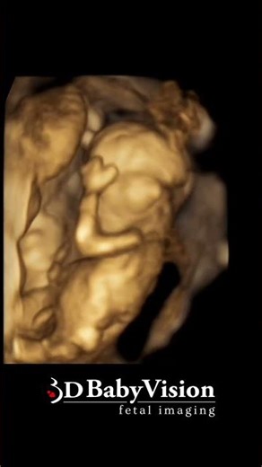 Already showing off those tiny muscles! - 3D BabyVision Hamilton