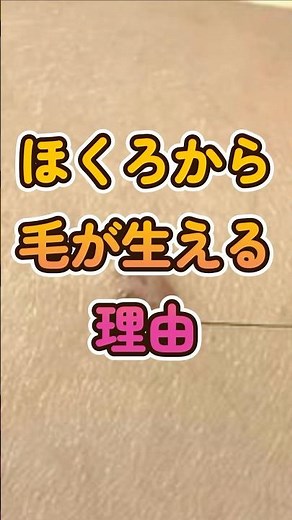 ほくろから毛が生える理由、知ってますか？
