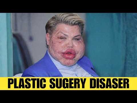 15 Celebrities Before and After Plastic Surgery | Then and Now 2026