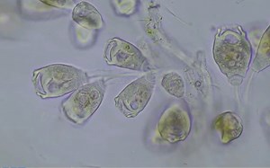 Carchesium ：一种海洋纤毛虫