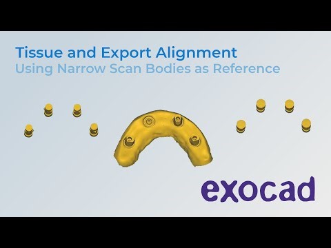 Nexus Connect Lab - Aligning Tissue Scan with Narrow Scan Bodies to Exports (Exocad)
